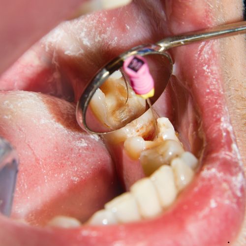 Best Dentistry in Perinthalmanna
